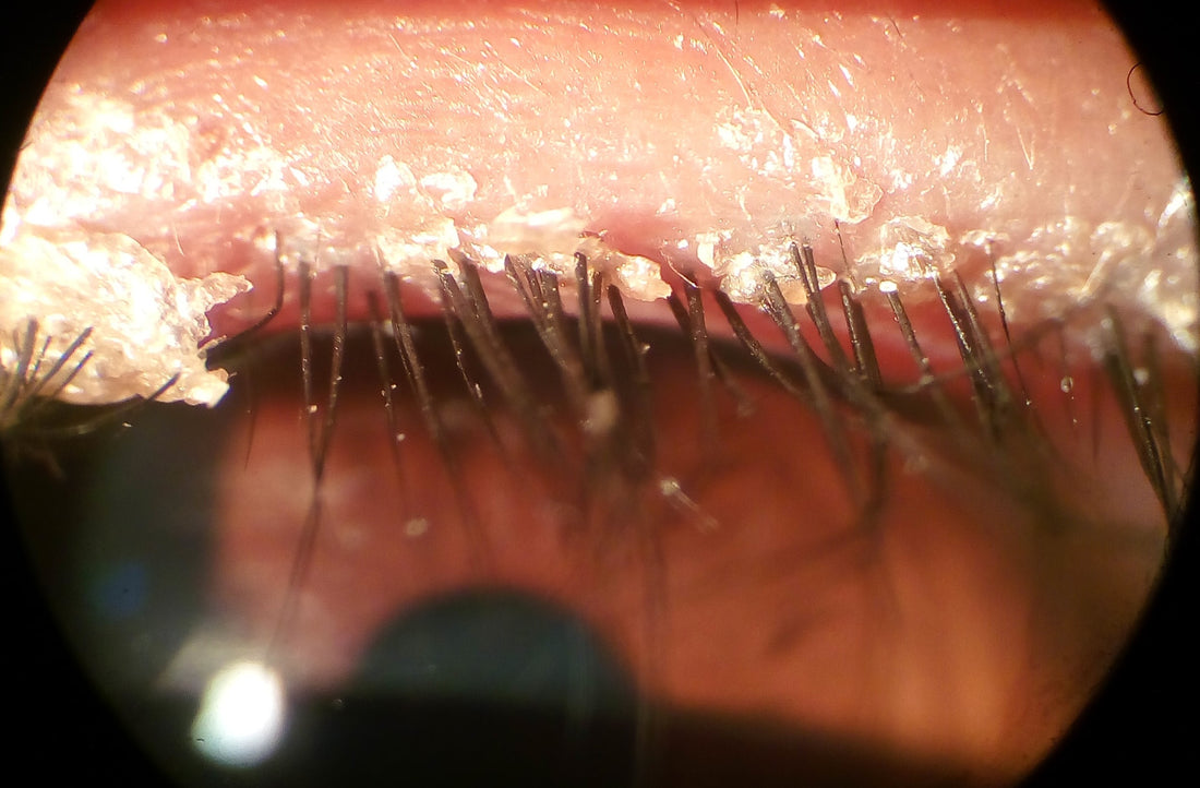 #81 - HOW TO STERILISE AND CLEAN TWEEZERS