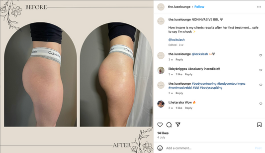 From Course To Cash Flow: How One Student is Shaping Their Way to a $286K Body Contouring Empire